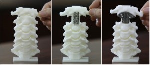 Vertebra 3D