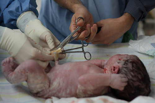 ¿Conviene cortar el cordón umbilical de forma tardía a los recién nacidos?