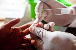 Existen métodos de diagnóstico convencionales de la malaria como por ejemplo el frotis sanguíneo o los kits de diagnóstico rápido. (Foto: Gates Foundation)