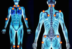 Nuevos marcadores diagnósticos de la fibromialgia