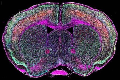 Estudian el papel de los genes víricos en la esclerosis lateral amiotrófica