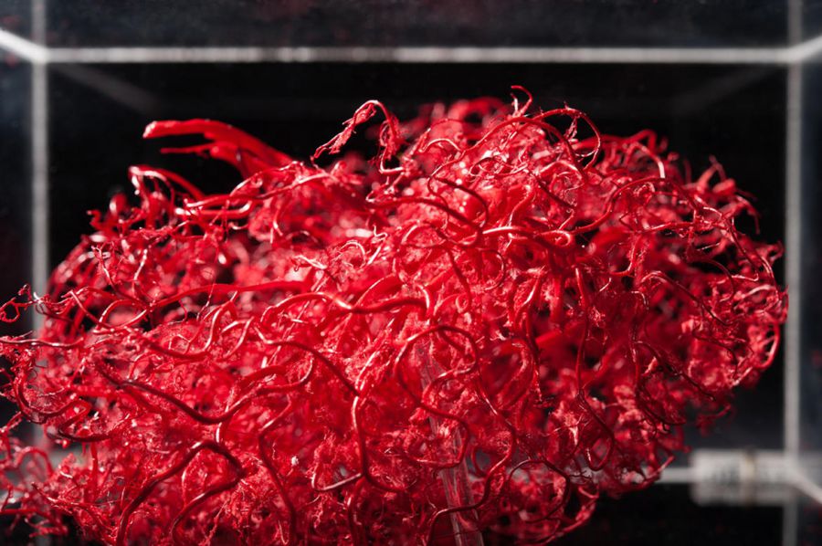 China produce los primeros vasos sanguíneos fabricados en una impresora 3D