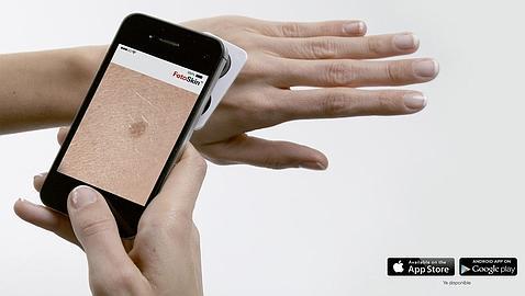 Una app diagnostica el cáncer de piel