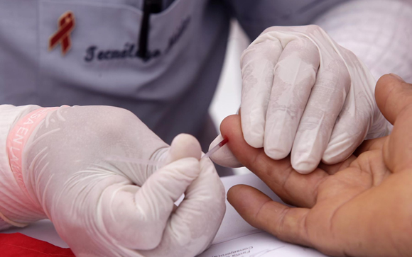 Desarrollan nuevo método de detección oral del VIH ‘más sensible’