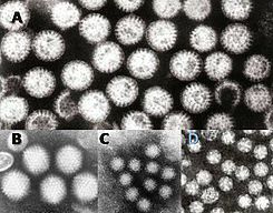 La gastroenteritis también en invierno
