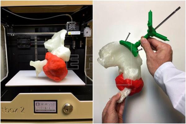Cirugías más precisas y hasta un 40 % más cortas gracias a impresoras 3D