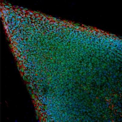 Científicos nipones crean células iPS capaces de regenerar el miocardio