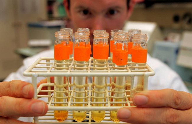 Descubren un tipo de célula inmunitaria con potencial contra la diabetes de tipo 1