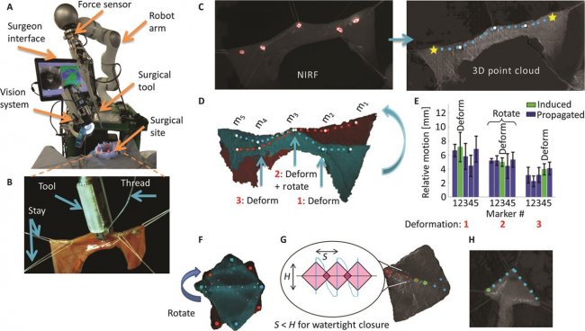 Un robot cirujano más preciso que un médico real