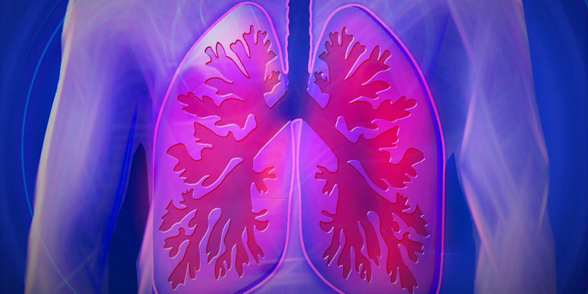 Prueban una terapia con células contra la fibrosis pulmonar