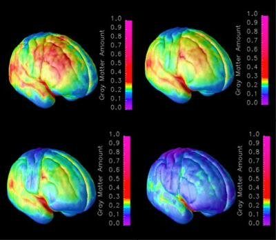 Descubren cómo las neuronas forman y mantienen sus extensiones nerviosas
