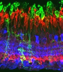 Desarrollan unas moléculas que ayudan a restaurar la degeneración de retina