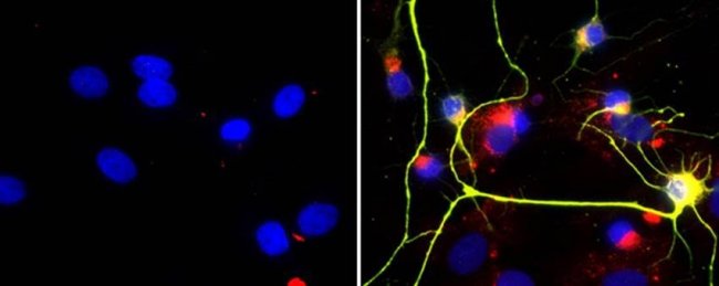 Estimulan en ratas la formación de nuevas neuronas inhibiendo una enzima cerebral