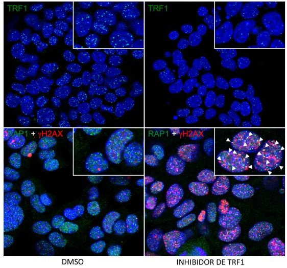 El CNIO encuentra una nueva diana terapéutica contra el cáncer de pulmón