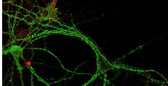 Descubren posible origen de déficit neuronales como epilepsia o autismo