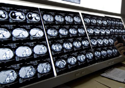 Salud inicia los trámites de licitación del nuevo equipo de resonancia magnética para el Hospital “Reina Sofía” de Tudela