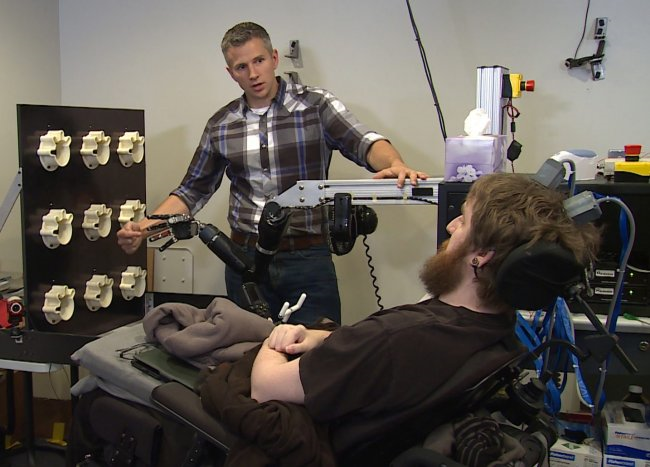 Recupera el tacto gracias a un implante cerebral y un brazo robótico