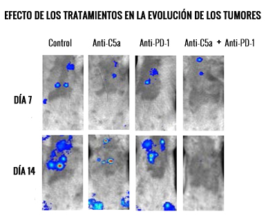 CIMA: Una nueva inmunoterapia combinada podría mejorar el tratamiento del cáncer de pulmón