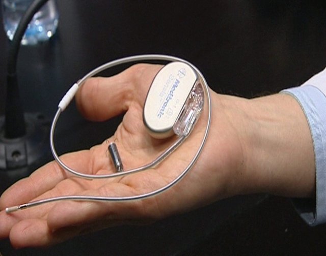 Avances en cardiología: hacia un marcapasos sin cables