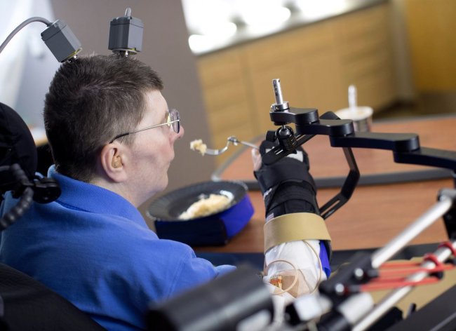 Un tetrapléjico logra comer y beber por sí mismo con una neuroprótesis