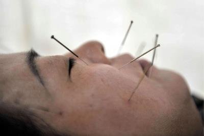 Más de la mitad de los españoles confía en la acupuntura y la homeopatía
