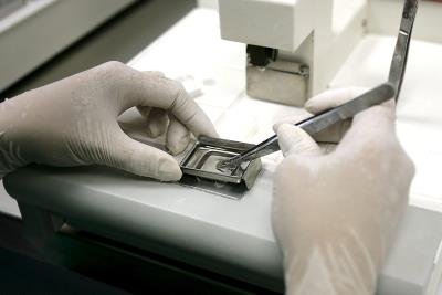 Un microscopio detecta tumores durante las operaciones