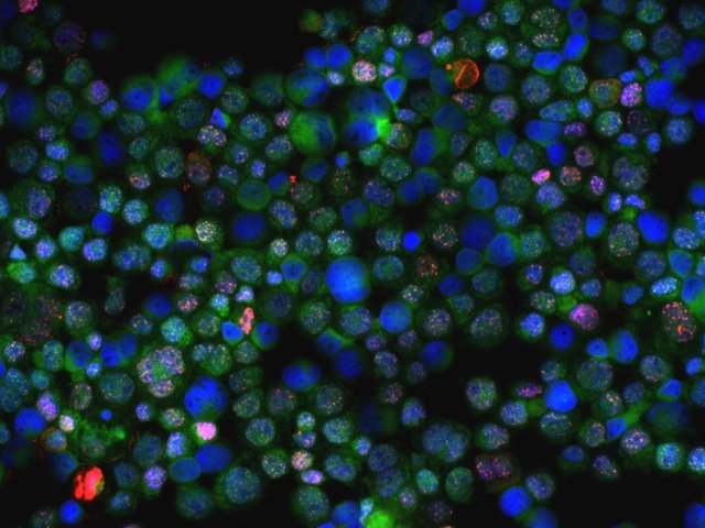 Óscar Llorca, del CNIO: ya hay tecnología que revolucionará el estudio del cáncer