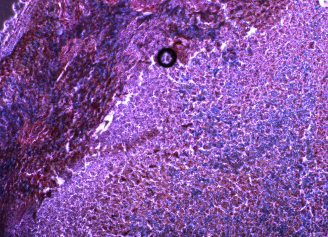 Descubren una biomolécula que ayuda al sistema inmunológico a superar el cáncer