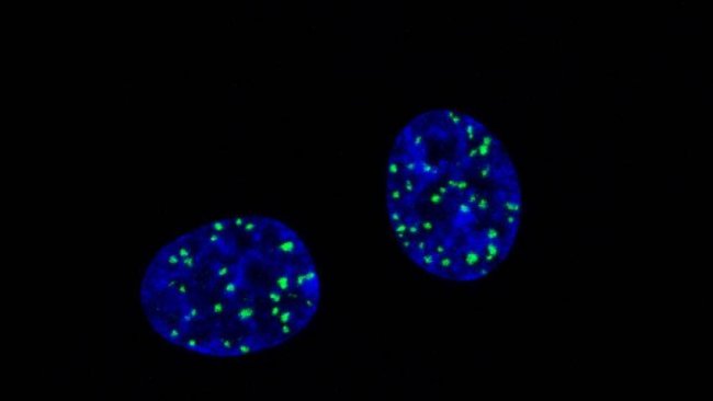 Descubren una proteína que repara las roturas del ADN causadas por la quimio