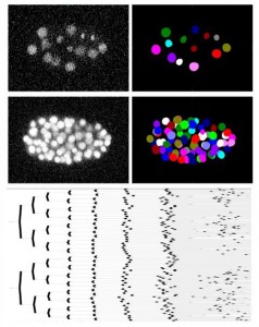 171107 Imagen microscopica challenge