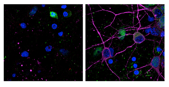 Identificado un mecanismo para prevenir la muerte neuronal que causan el ictus o el alzhéimer