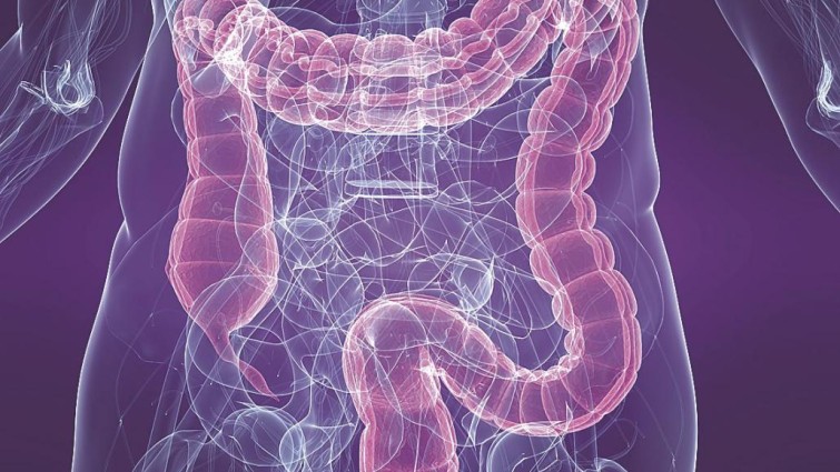 Descubierto un nexo entre compuestos químicos y enfermedades inflamatorias intestinales