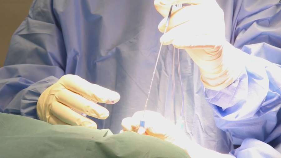 Avances técnicos hacen que más pacientes epilépticos puedan optar a cirugía