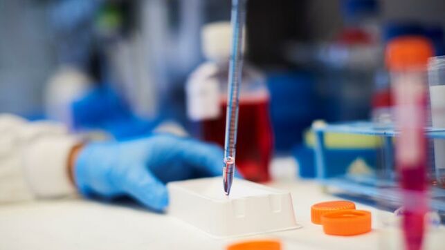 Un 26 % de las roturas de aneurisma cerebral se confunden con una migraña