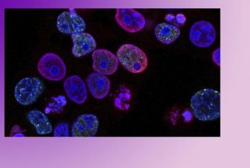 El CSIC lanza un estudio genético para identificar el riesgo individual de desarrollar formas graves de coronavirus