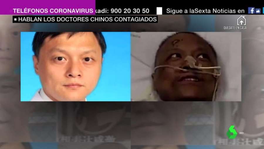 Muere el médico chino que se volvió negro tras contraer el coronavirus
