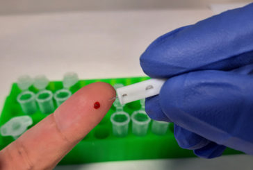 El CSIC desarrolla un test de coronavirus fiable casi al 99%