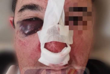 SUP denuncia violencia extrema contra los policías